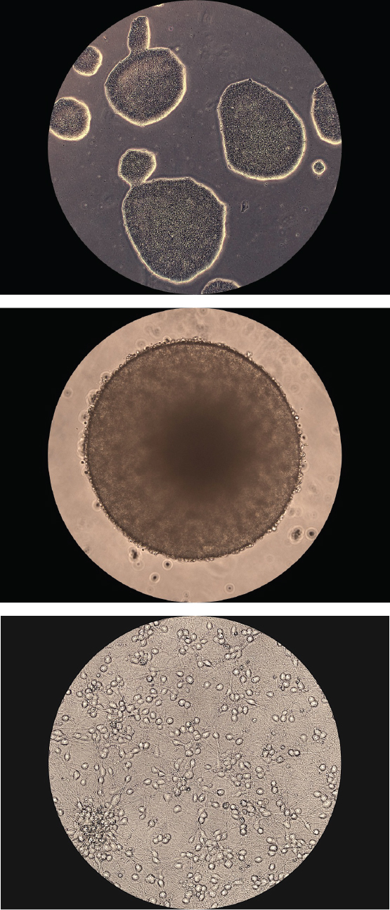 Brain organoids and iPSC cultures from Chen Lab